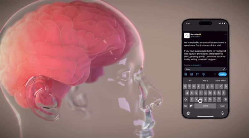 neuralink chipset allows you to control your smartphone